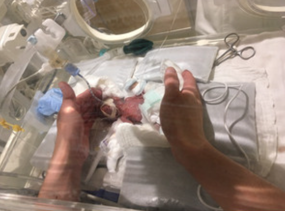 祝！世界で一番小さい赤ちゃん無事退院